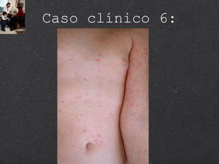 Caso clínico 6: 