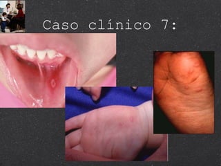 Caso clínico 7: 