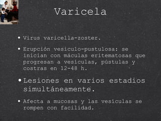 Varicela Virus varicella-zoster. Erupción vesiculo-pustulosa: se inician con máculas eritematosas que progresan a vesículas, pústulas y costras en 12-48 h. Lesiones en varios estadios simultáneamente. Afecta a mucosas y las vesículas se rompen con facilidad. 
