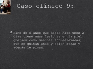 Caso clínico 9: Niño de 5 años que desde hace unos 2 días tiene unas lesiones en la piel que son como manchas sobreelevadas, que se quitan unas y salen otras y además le pican.  