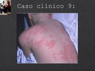 Caso clínico 9: 