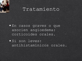 Tratamiento En casos graves o que asocien angioedema: corticoides orales. Si son leves: antihistamínicos orales. 