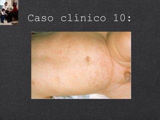 Caso clínico 10: 