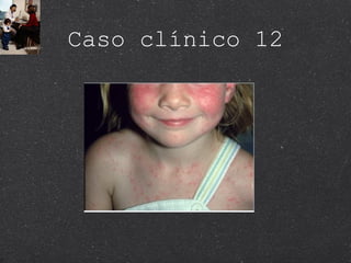 Caso clínico 12 