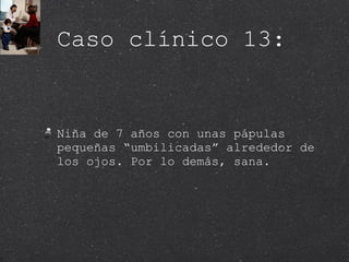 Caso clínico 13: Niña de 7 años con unas pápulas pequeñas “umbilicadas” alrededor de los ojos. Por lo demás, sana.  