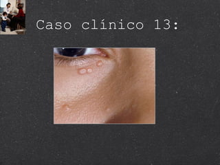 Caso clínico 13: 