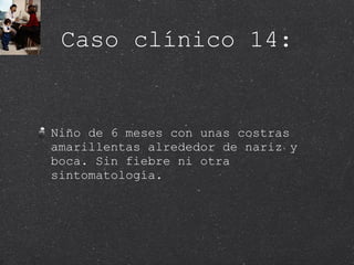 Caso clínico 14: Niño de 6 meses con unas costras amarillentas alrededor de nariz y boca. Sin fiebre ni otra sintomatología. 