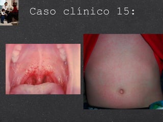 Caso clínico 15: 