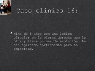 Caso clínico 16: Nina de 5 años con una lesión circular en la pierna derecha que la pica y tiene un mes de evolución. Le han aplicado corticoides pero ha empeorado. 