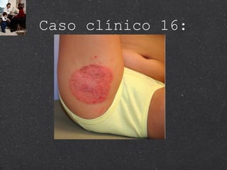 Caso clínico 16: 