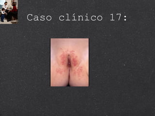 Caso clínico 17: 