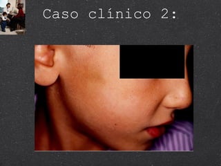 Caso clínico 2: 