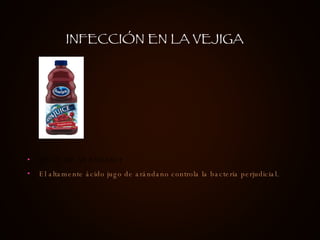 JUGO DE ARÁNDANO El altamente ácido jugo de arándano controla la bacteria perjudicial.  INFECCIÓN EN LA VEJIGA 