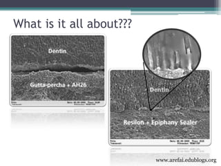 3rd year Obturation Lecture