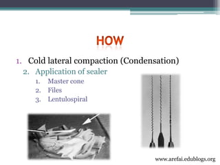 3rd year Obturation Lecture