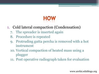 3rd year Obturation Lecture