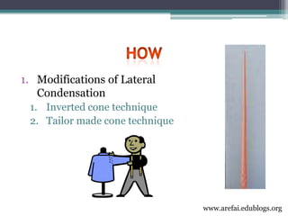 3rd year Obturation Lecture