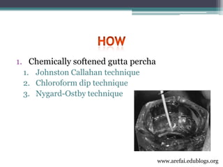 3rd year Obturation Lecture