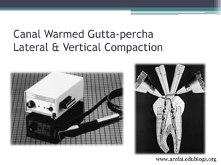 3rd year Obturation Lecture