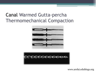 3rd year Obturation Lecture