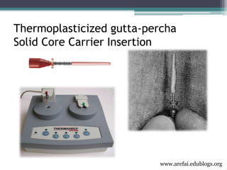 3rd year Obturation Lecture