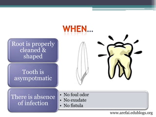 3rd year Obturation Lecture