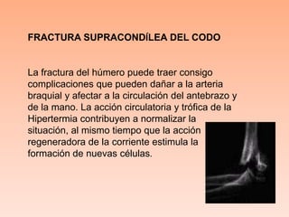Fractura supracondílea del codo La fractura del húmero puede traer consigo complicaciones que pueden dañar a la arteria braquial y afectar a la circulación del antebrazo y de la mano. La acción circulatoria y trófica de la Hipertermia contribuyen a normalizar la situación, al mismo tiempo que la acción regeneradora de la corriente estimula la formación de nuevas células. 