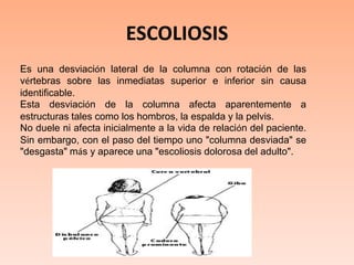 ESCOLIOSISEs una desviación lateral de la columna con rotación de las vértebras sobre las inmediatas superior e inferior sin causa identificable.Esta desviación de la columna afecta aparentemente a estructuras tales como los hombros, la espalda y la pelvis.No duele ni afecta inicialmente a la vida de relación del paciente. Sin embargo, con el paso del tiempo uno "columna desviada" se "desgasta" más y aparece una "escoliosis dolorosa del adulto".