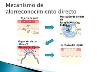 Trasplante Ortópico:El injerto se coloca en su localización anatómica habitualTrasplante Heterópico:El injerto se coloca en un sitio diferente a su localización habitual