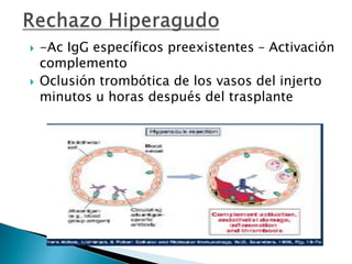 Presentación directa de aloantígenos: Reconocimiento CRUZADOUnión dominantedel péptidoUniónpéptido extraño-HLA propioUnión dominantedel HLA