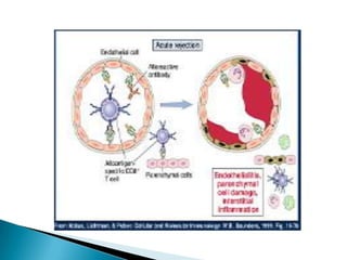 Reacciones mediadas por anticuerpos.