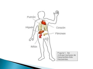 SALAZAR TACANGA, MARÍA TERESATRULILLO  -  PERU              2009
