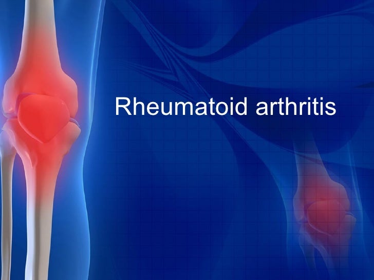 RHEUMATOID ARTHRITIS RHEUMATOID ARTHRITIS