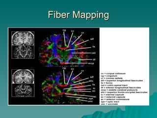 DTI Fiber Tracking | PPT