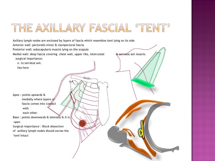 surgical anatomy of breast & management of advanced carcinoma breast