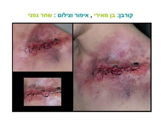 קורבן :   בן מאירי   ,  איפור וצילום  :   שחר גפני 