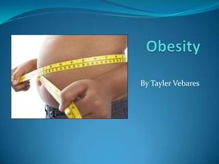 Obesity By Tayler Vebares 