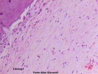 Aspecto Histopatológico Fonte Allan Giovanini Lâmina 1 