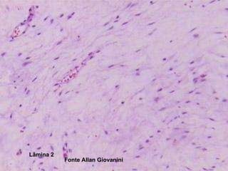 Lâmina 2 Fonte Allan Giovanini 