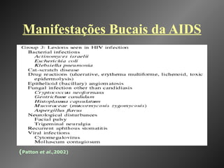 Manifestações Bucais da AIDS ( Patton  et al .,2002) 