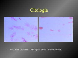 Citologia Prof. Allan Giovanini – Patologista Bucal – UnicenP/UFPR 