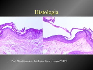 Histologia Prof. Allan Giovanini – Patologista Bucal – UnicenP/UFPR 