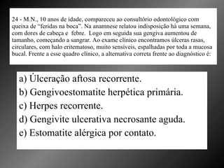 24 - M.N., 10 anos de idade, compareceu ao consultório odontológico com queixa de “feridas na boca”. Na anamnese relatou indisposição há uma semana,  com dores de cabeça e  febre.  Logo em seguida sua gengiva aumentou de  tamanho, começando a sangrar. Ao exame clínico encontramos úlceras rasas, circulares, com halo eritematoso, muito sensíveis, espalhadas por toda a mucosa bucal. Frente a esse quadro clínico, a alternativa correta frente ao diagnóstico é: a) Úlceração aftosa recorrente. b) Gengivoestomatite herpética primária. c) Herpes recorrente. d) Gengivite ulcerativa necrosante aguda. e) Estomatite alérgica por contato. 