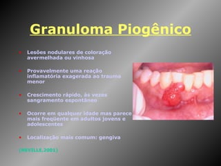 Granuloma Piogênico Lesões nodulares de coloração avermelhada ou vinhosa Provavelmente uma reação inflamatória exagerada ao trauma menor Crescimento rápido, às vezes sangramento espontâneo Ocorre em qualquer idade mas parece mais freqüente em adultos jovens e adolescentes  Localização mais comum: gengiva (NEVILLE,2001) 
