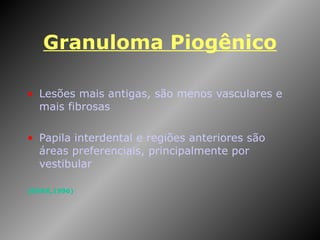 Granuloma Piogênico Lesões mais antigas, são menos vasculares e mais fibrosas Papila interdental e regiões anteriores são áreas preferenciais, principalmente por vestibular (BORK,1996) 