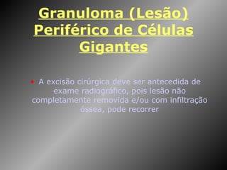 Granuloma (Lesão) Periférico de Células Gigantes A excisão cirúrgica deve ser antecedida de exame radiográfico, pois lesão não completamente removida e/ou com infiltração óssea, pode recorrer 