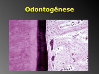 Odontogênese 