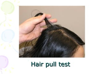 Alopecia | PPT
