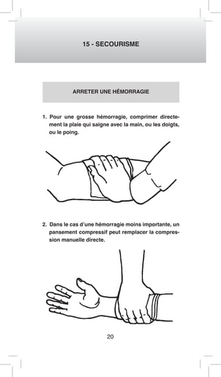 20 
15 - SECOURISME 
ARRETER UNE HÉMORRAGIE 
1. Pour une grosse hémorragie, comprimer directe-ment 
la plaie qui saigne avec la main, ou les doigts, 
ou le poing. 
2. Dans le cas d’une hémorragie moins importante, un 
pansement compressif peut remplacer la compres-sion 
manuelle directe. 
 