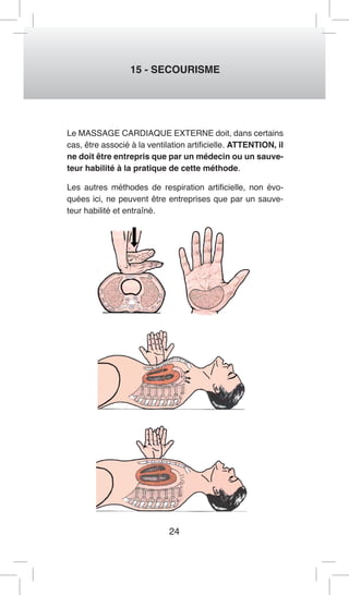 24 
15 - SECOURISME 
Le MASSAGE CARDIAQUE EXTERNE doit, dans certains cas, être associé à la ventilation artificielle. ATTENTION, il ne doit être entrepris que par un médecin ou un sauveteur habilité à la pratique de cette méthode. 
Les autres méthodes de respiration artificielle, non évoquées ici, ne peuvent être entreprises que par un sauveteur habilité et entraîné.  